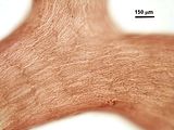 5 – Cellule corticali in visione superficiale